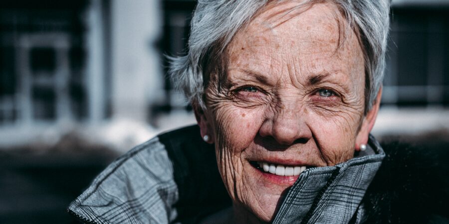 Hyperpigmentation treatments Swindon